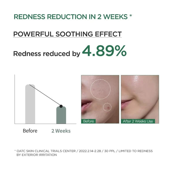 Anua - Heartleaf 80% Soothing Ampoule